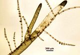 2 – Tallo epifita su Bryopsis sp